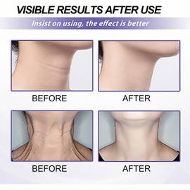 Samu Neck Firming Cream,Wak Firming & Lifting Ne-ck Cream,Anti Aging Ne-ck Cream for Sagging and Tighten,Firm-ing Cre-am for Loose Skin,Ne-ck Tightening Products,Ne-ck Tightening Cre-am,Ne-ck Fir-ming