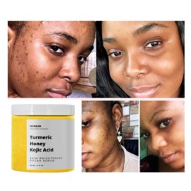 Skin Whitening Dark Spots Lightening Acne Brightening Turmeric Honey Kojic Acid