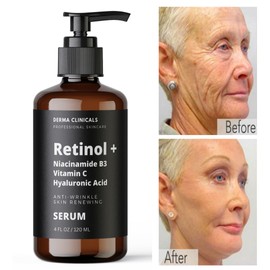 Retinol + Collagen, Hyaluronic Acid, Vitamin C AntiAging Wrinkle Serum Cream 4oz