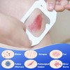 100 Count Transparent Film Dressing, Waterproof Bandages Post Surgical for