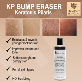 Healfast KP Bump Eraser Cream (4 Oz) and Bodywash (8 Oz) Set – Soften, Exfoliate, Nourish Rough and Bumpy Skin – Keratosis Pilaris - For All Types