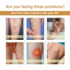 Crema Para Venas Varicosas,alivia Dolor Y Eliminar Varices*2
