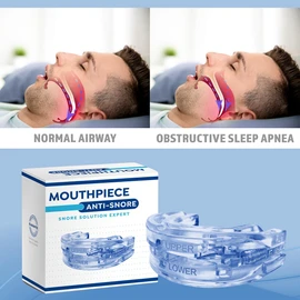 Color Azul - Guarda dental para dormir para evitar los ronquidos. Talla única y ajustable para adaptarse a cualquier tamaño de boca. Estuche incluido. Manual de instrucciones incluido. Ayuda a respirar mejor, dormir mejor y roncar menos. Ayuda a prevenir 