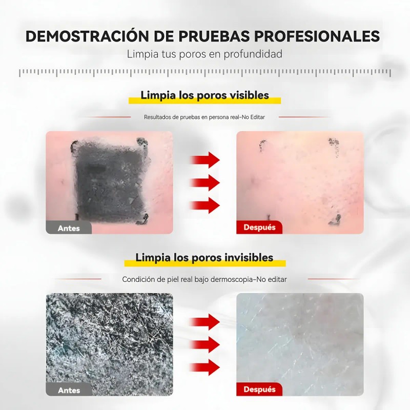 Limpiador Facial Vgo 2 En 1 Máscara De Barro Y