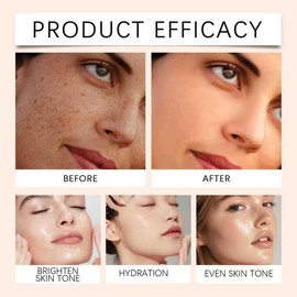 Sérum de Vitamina C para Mujer, Antimanchas Faciales, Sérum Antiedad y Antimanchas - Ilumina la Piel, Apto para Todo Tipo de Piel, Hidrata y Reafirma la Piel, Reduce Arrugas y Tonifica (1 PCS)