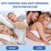 Knirscherschiene Für Nacht, 4 Formbare Mundschutz zum Zähneknirschen, 2 Größen