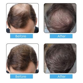 Hair Fibers Spray Refill Powder 100 Grams,Medium Brown,Thinning Fine Hair Loss Concealer,Undetected & Unscented,Refill Exsiting Shaker Bottle