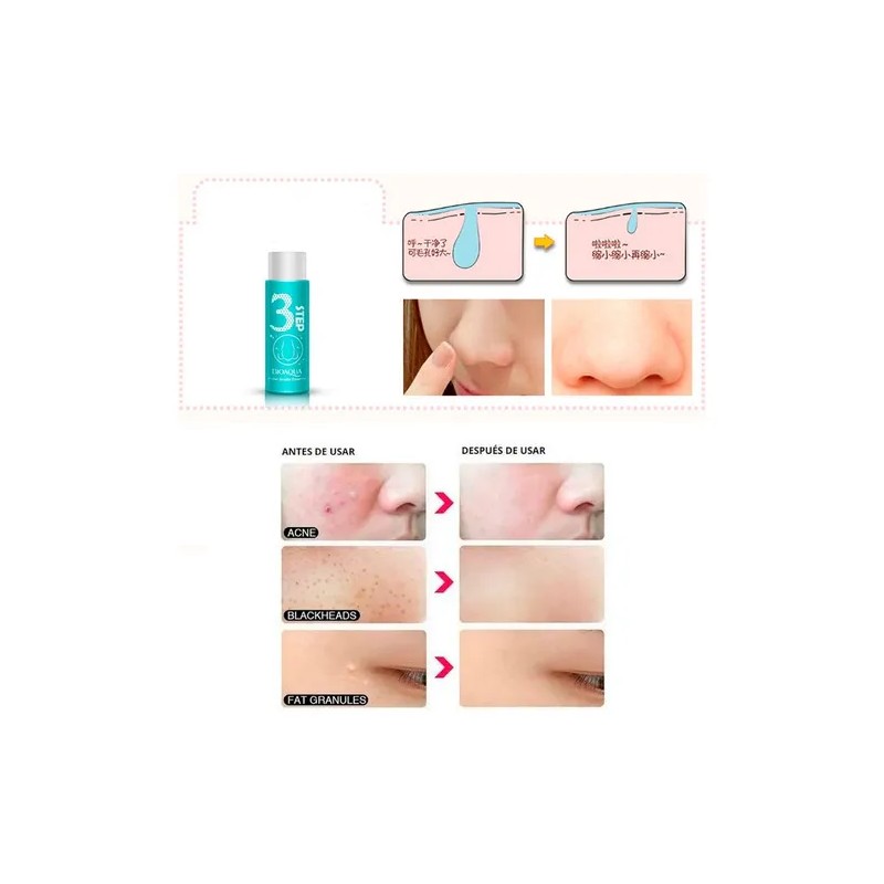 Holika Pig Nose Puntos Negros 3 Pasos Anti Acne Aclarante