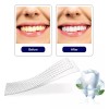 Alien Technology 28 Tiras Blanqueadoras Dentales 5d White Higiene Bucal