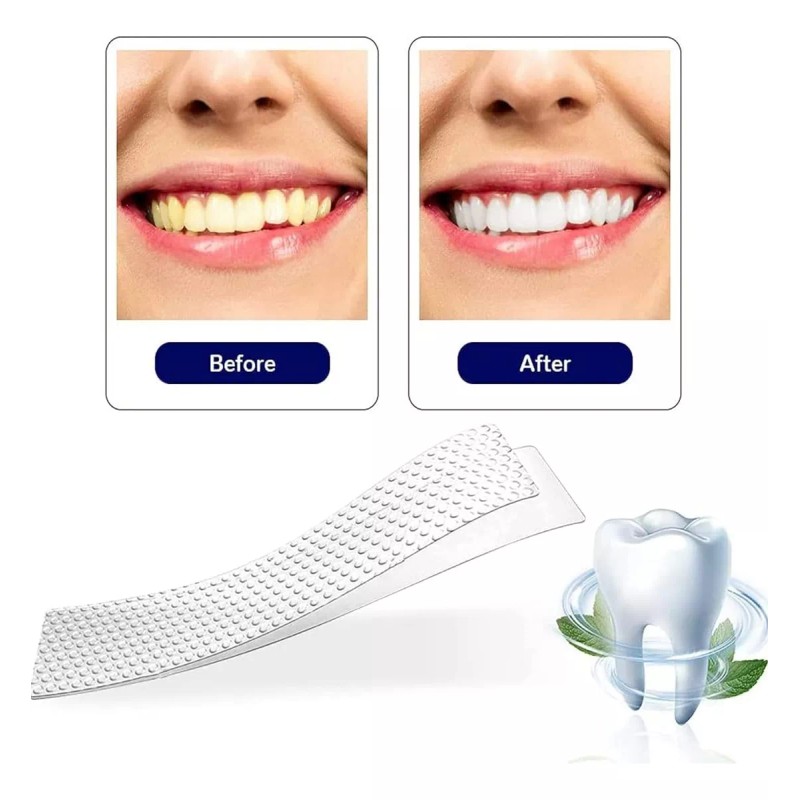 Alien Technology 28 Tiras Blanqueadoras Dentales 5d White Higiene Bucal