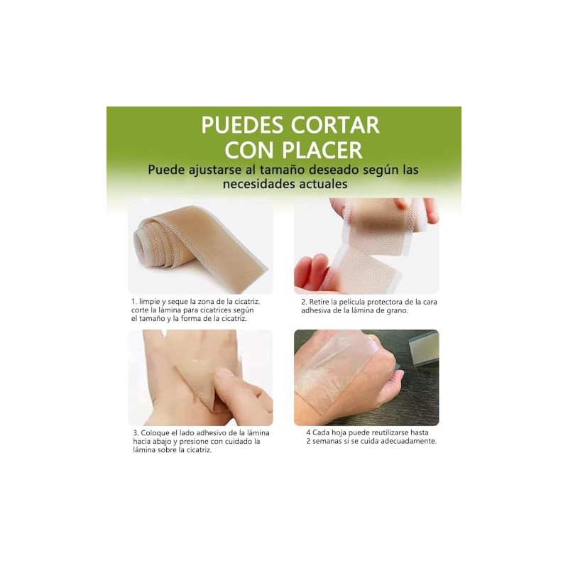 Cinta para eliminar cicatrices(rollo de 4cm x 1.5 m), eliminación