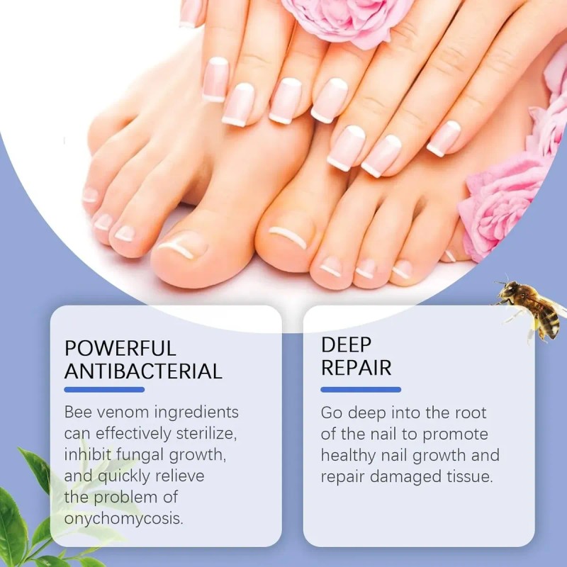 Tratamiento De Uñas De Los Pies Para Mujeres, Extractos De