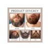 2pcs Cosmetics Para Barba, Hidrata Y Fortalece La Barba T
