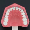 Dentalmall Typodonts Orthodontics Demonstration Model with Metal Wires and Bracket