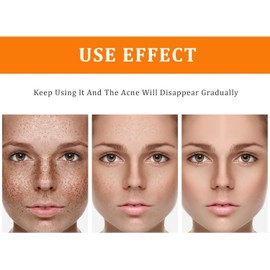 Yahoo! Speech Toner for Dark Spots Turmeric Spot Corrector Facial Correction Moisturizing Face for Acne-prone Skin - Women's 3.4 OZ Suitable for All Skin Types / 다크 스팟용 야후시페 토너 강황 스팟 교정제 여드름성 피부용 페이셜 교정 보습용 페이스 - 모든 피부 타입에 적합한 여성용 3.4 OZ