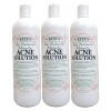 Miracle Tate's The Natural Miracle Acne Solution 8 Oz Set
