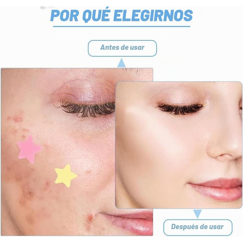 MYDEAR 480 Parches para Acné, Parches Hidrocoloides para Espinillas, Calcomanías