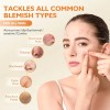 Bálsamo De Día Antiacné Organics 2.0 Tratamiento Botánico