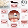 VEZE Tooth Repair Kit-Thermal Fitting Beads Granules and Fake Teeth