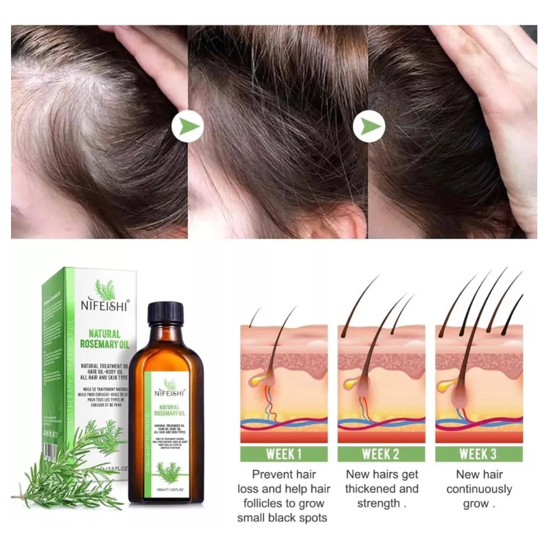 Aceite Fortalecedor Romero Cabello Pestañas Ceja 100% Natura