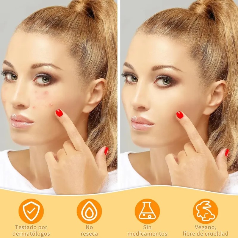 Miniso Tiras Nasales Para Mujer Puntos Negros Rosa 10 Piezas