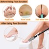 Gobiteli Toe Cleaning Brush, 18.8"-25.9" Telescopic Long Handle Foot Brush,Foot