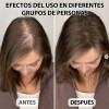 Gorra Laser Crecimiento Capilar Therapy Cabello Luz Red Usb