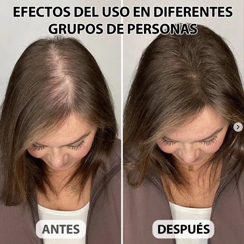 Gorra Laser Crecimiento Capilar Therapy Cabello Luz Red Usb