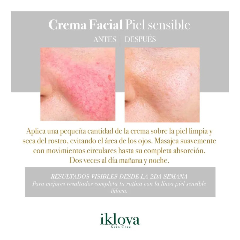 Crema Iklova Piel Sensible 40g Hidratación Profunda Piel Sensible Día/noche