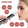 Electric Vacuum Blackhead Remover Rechargeable Face Pore Cleaner Acne Whitehead