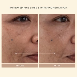 SHANI DARDEN SKINCARE Retinol Reform Duo, Full and Travel Size Anti-Aging Serum, Resurfacing Retinol Serum for Face and Neck, Helps with Fine Lines and Wrinkles, 2-Piece Set