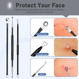 Professional Pimple Popper Tool Kit,10 PCS Blackhead Remover Tweezers,Extractor Acne Removal Kit for Easy Removal for Pimples,Comedone Extractor Tools for Removing Zit,Acne Removal Kit (Black)