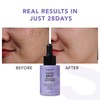 Dark Spot Correcting Glow Serum: Melasma Hyperpigmentation Treatment for Face