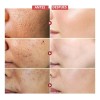 Serum Suero Con Acido Hialuronico Vitamina E Antiarrugas