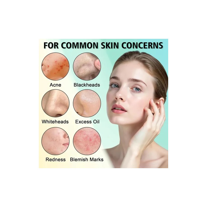 Tratamiento Para El Acné Facial, Crema Antiacné, Crema Para