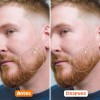 BU Roller Facial Estimula El Crecimiento De La Barba Colágeno