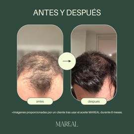 Aceite de Romero Orgánico para El Crecimiento Del Cabello Con Aceite de Coco Y Castor Oil Perfecto para Cabello Seco, Dañado Y Fino Textura Ligera 100% Puro Y Natural 50 Ml