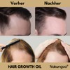 Nakungoo NAKUNGOO Hair Growth Oil Rosemary Essential Oil to Accelerate