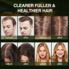 Batana Aceite Esencial Champú Cuidado Del Cabello 420ml