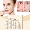 Kit facial de arroz 5 en 1 para mujer –