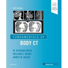 Fundamentals of Body CT (Fundamentals of Radiology)