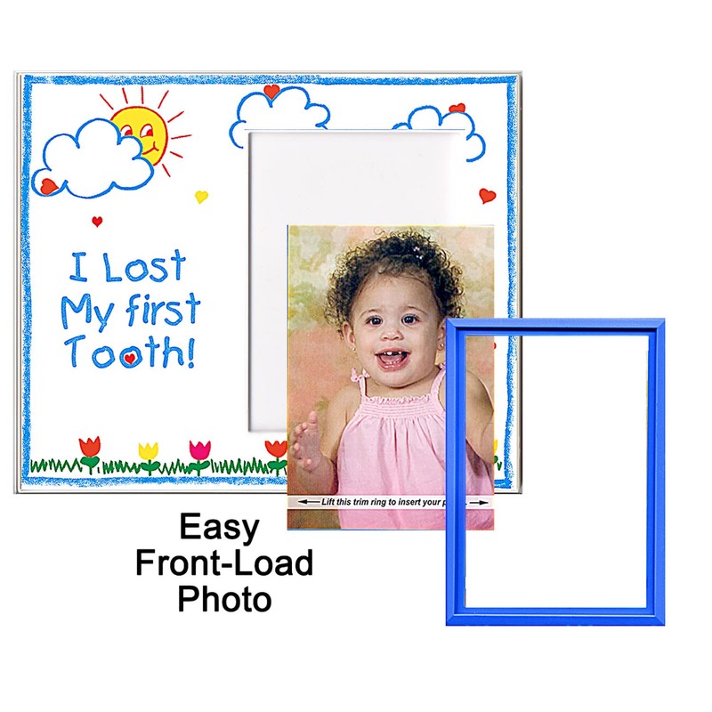 I Lost My First Tooth! - Picture Frame Gift
