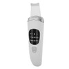 Face Skin Scrubber Vibration Face Peeling Machine Ultrasonic Exfoliating Skin‑Care