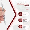 Debbery 2Pcs Blackhead Remover Tool, Threaded Non Slip Design, Stainless