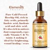Generic Rosehip oil for face Glowing & Brightening, anti-ageing rosehip