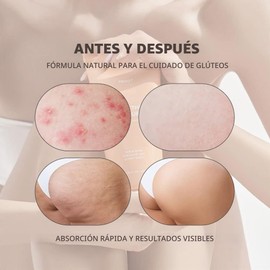 Exfoliante para Glúteos y Muslos Choice Cosmetics Co., Ltd - Piel Suave y Uniforme 6.5 oz