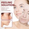 Solución Peeling Facial AHA BHA - Sérum Exfoliante Facial con