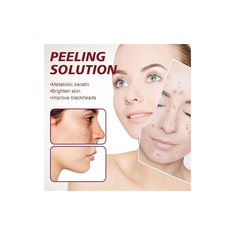 Solución Peeling Facial AHA BHA - Sérum Exfoliante Facial con