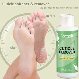 Fcozpjk Foot Cuticle Softener With Scraper, Foot Cuticle Remover Cream Callus Remover Gel 177ml/6.23 Fl Oz, Stainless Steel Pedicure Knife Cuticle Scraper, Professional Pedicure Kit Foot Spa Tool