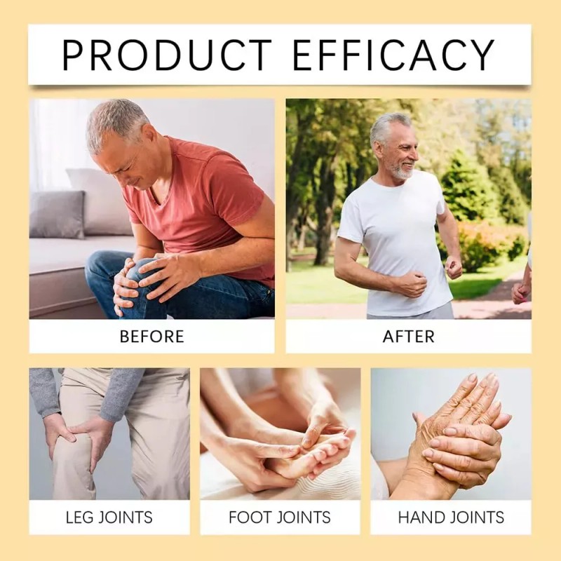 Crema Corporal Para Aliviar El Dolor Articular, 5 Unidades